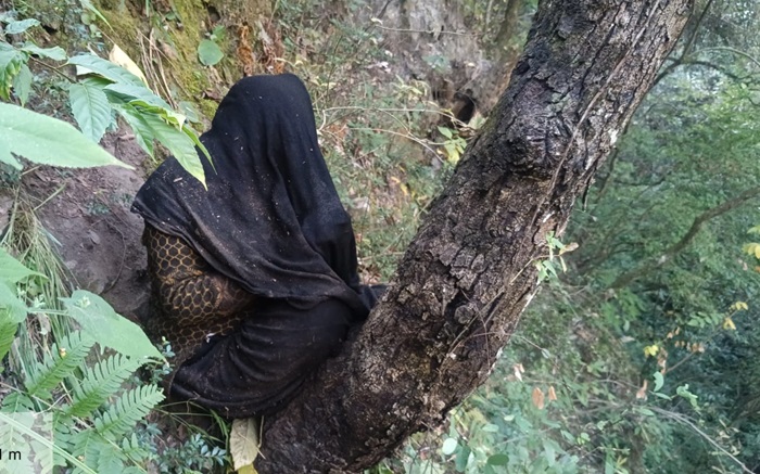 भालू के हमले में जख्मी महिला